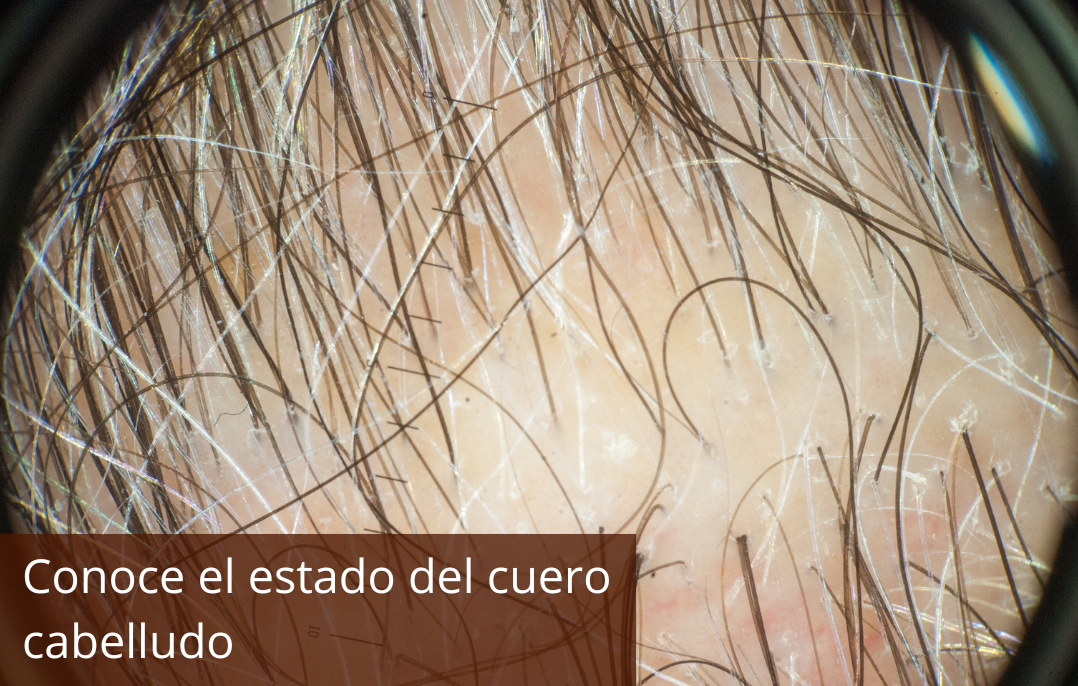 Tu cuero cabelludo tiene mucho que decir